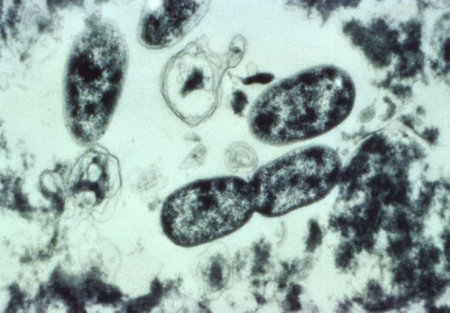 Microscopic view of Legionella pneumophila bacteria
